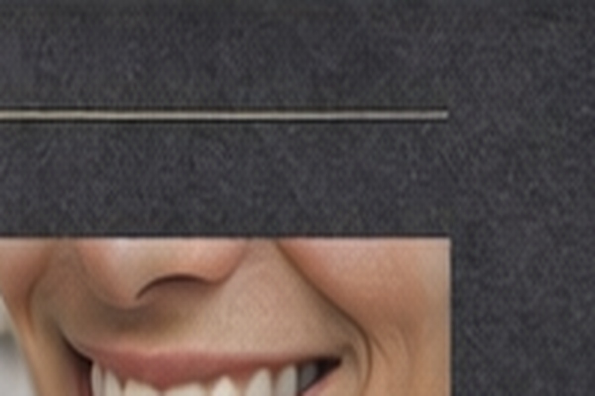 Premium Dental Veneers